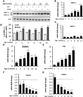 Pharmacological Inhibition of Inositol-Requiring Enzyme 1α RNase Activity Protects Pancreatic Beta Cell and Improves Diabetic Condition in Insulin Mutation-Induced Diabetes